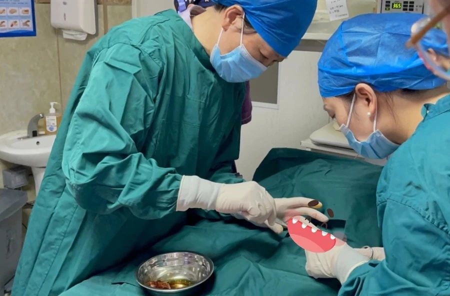 泗阳医院新生儿科成功实施首例脐静脉置管术